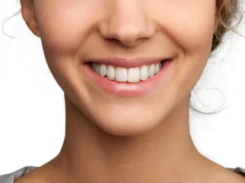 יישור שיניים